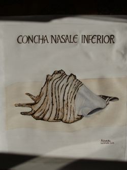 Concha Nasale Inferior